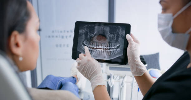 Licensed Tooth Extraction service in White Plains, NY - Smile Center Dentistry